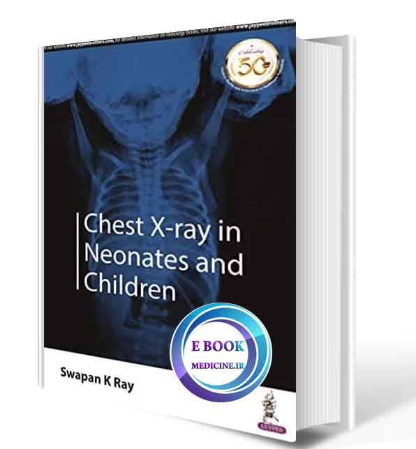 دانلود کتاب Chest X-ray in Neonates and Children 2019 (ORIGINAL PDF)